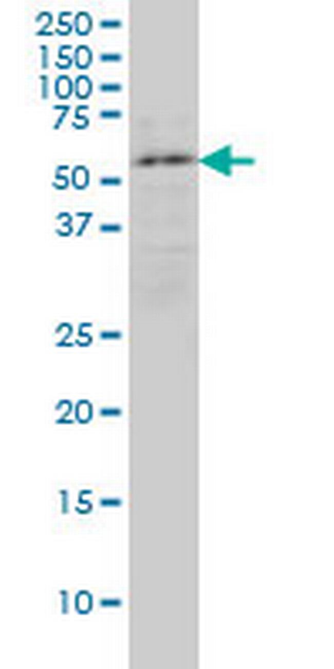 ENC1 Antibody in Western Blot (WB)