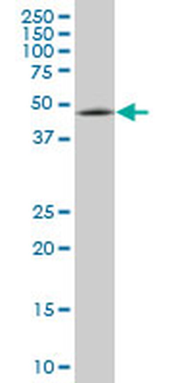 ENC1 Antibody in Western Blot (WB)