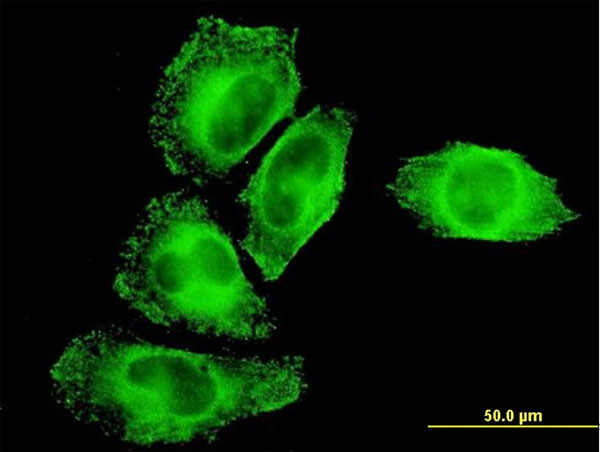 IKBKG Antibody in Immunocytochemistry (ICC/IF)