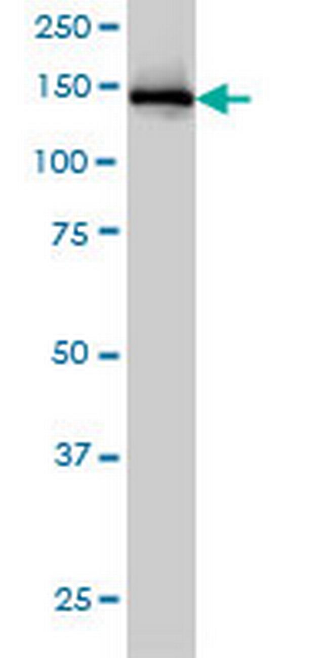 IKBKAP Antibody in Western Blot (WB)