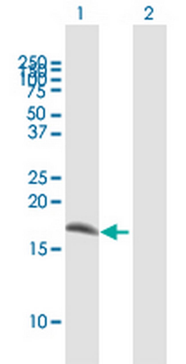 IFITM1 Antibody in Western Blot (WB)