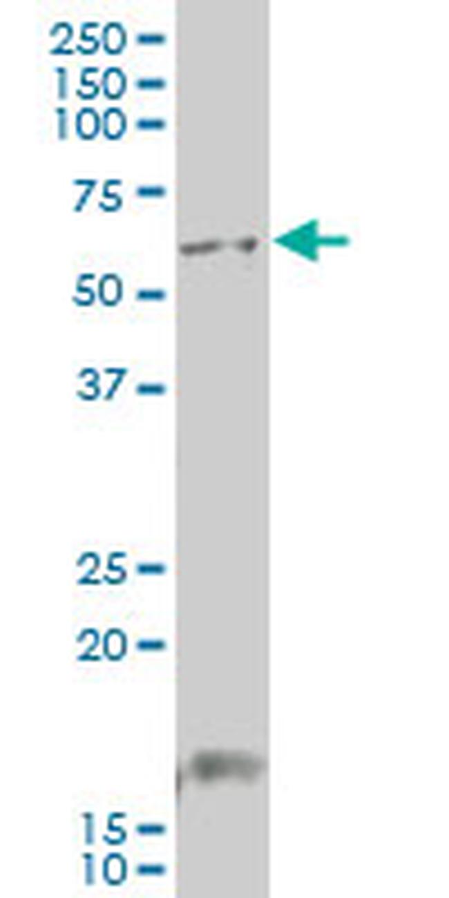 GCM1 Antibody in Western Blot (WB)