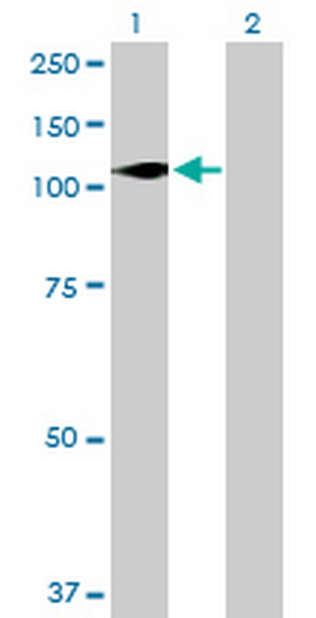 DGKZ Antibody in Western Blot (WB)