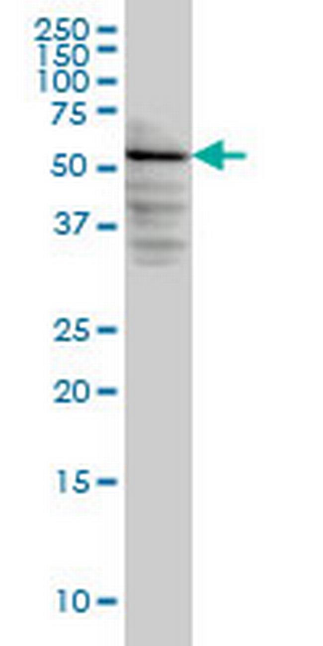 DGKE Antibody in Western Blot (WB)