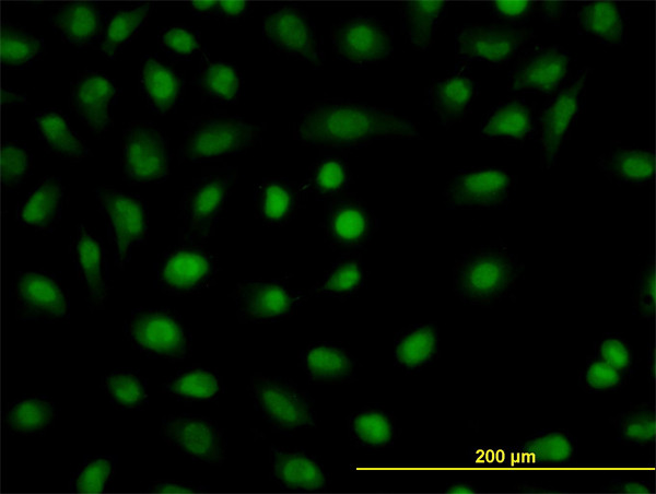 CSDA Antibody in Immunocytochemistry (ICC/IF)