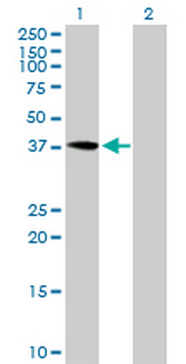 PRPF18 Antibody in Western Blot (WB)