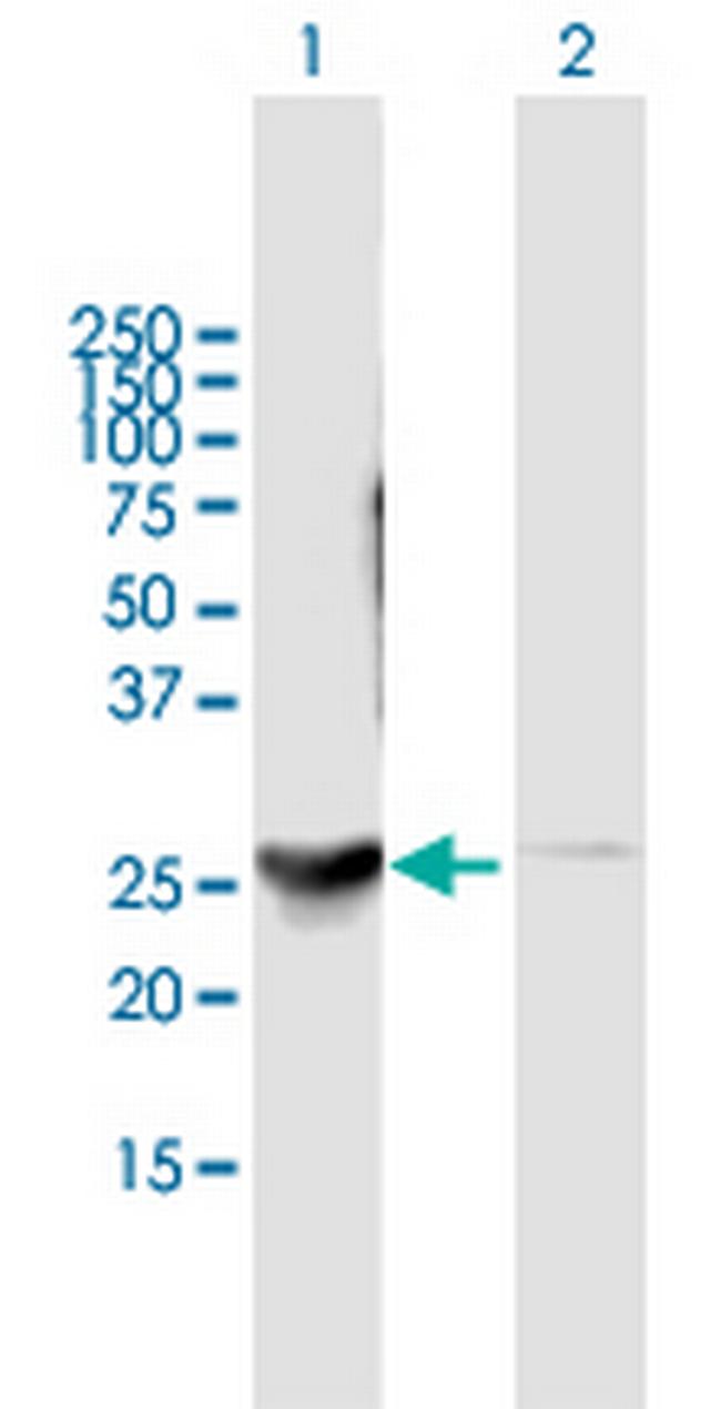 DENR Antibody in Western Blot (WB)