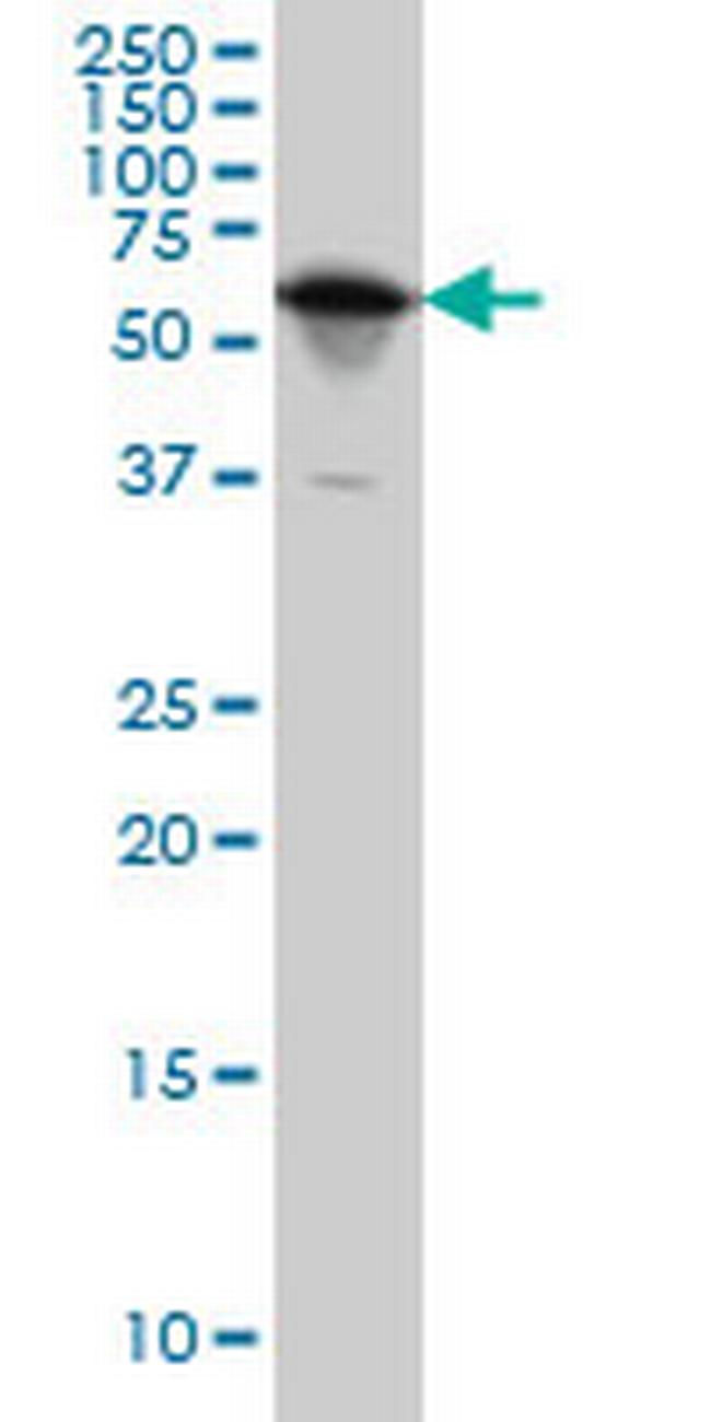 YARS Antibody in Western Blot (WB)