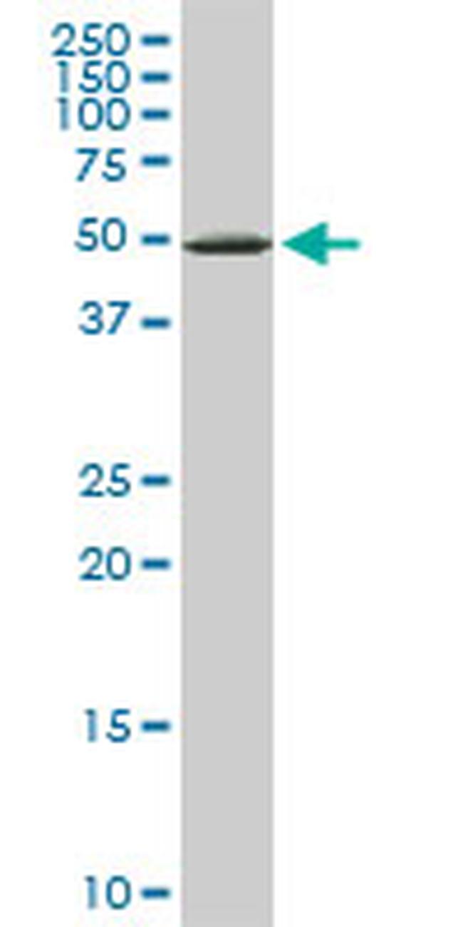 YARS Antibody in Western Blot (WB)