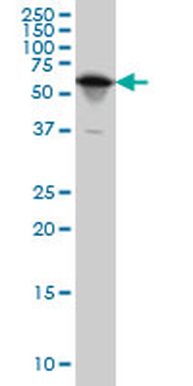 YARS Antibody in Western Blot (WB)