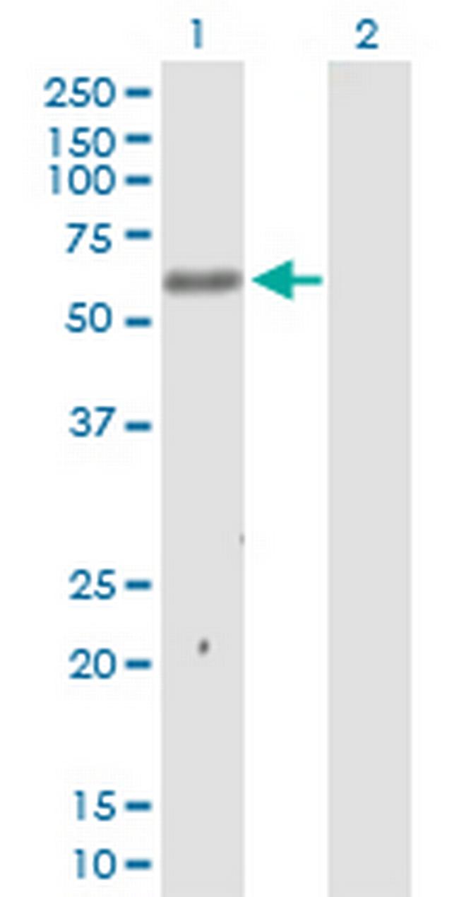 MKNK1 Antibody in Western Blot (WB)