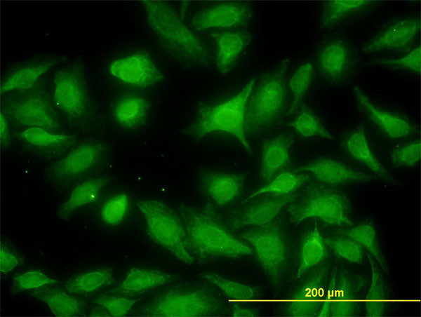 MKNK1 Antibody in Immunocytochemistry (ICC/IF)