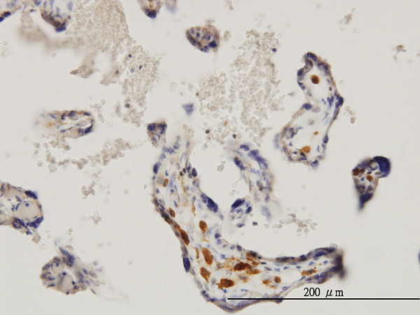 MKNK1 Antibody in Immunohistochemistry (Paraffin) (IHC (P))