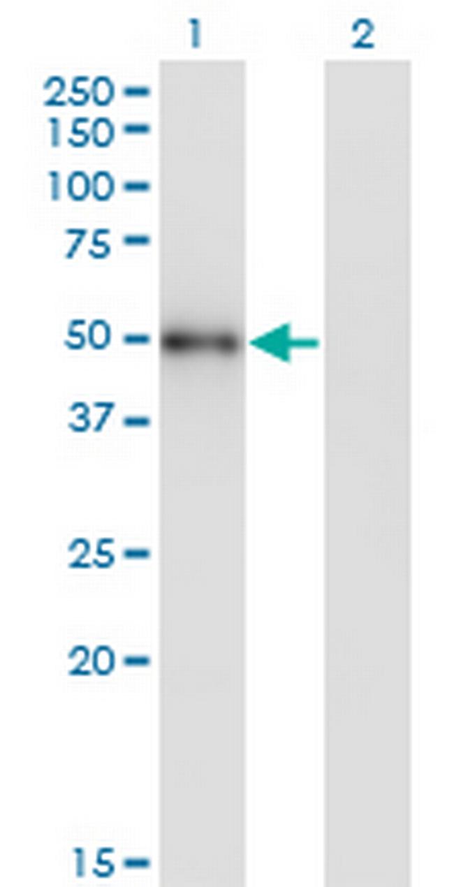 MKNK1 Antibody in Western Blot (WB)