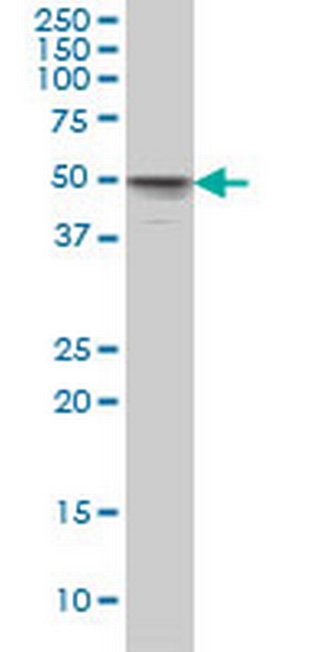 MKNK1 Antibody in Western Blot (WB)