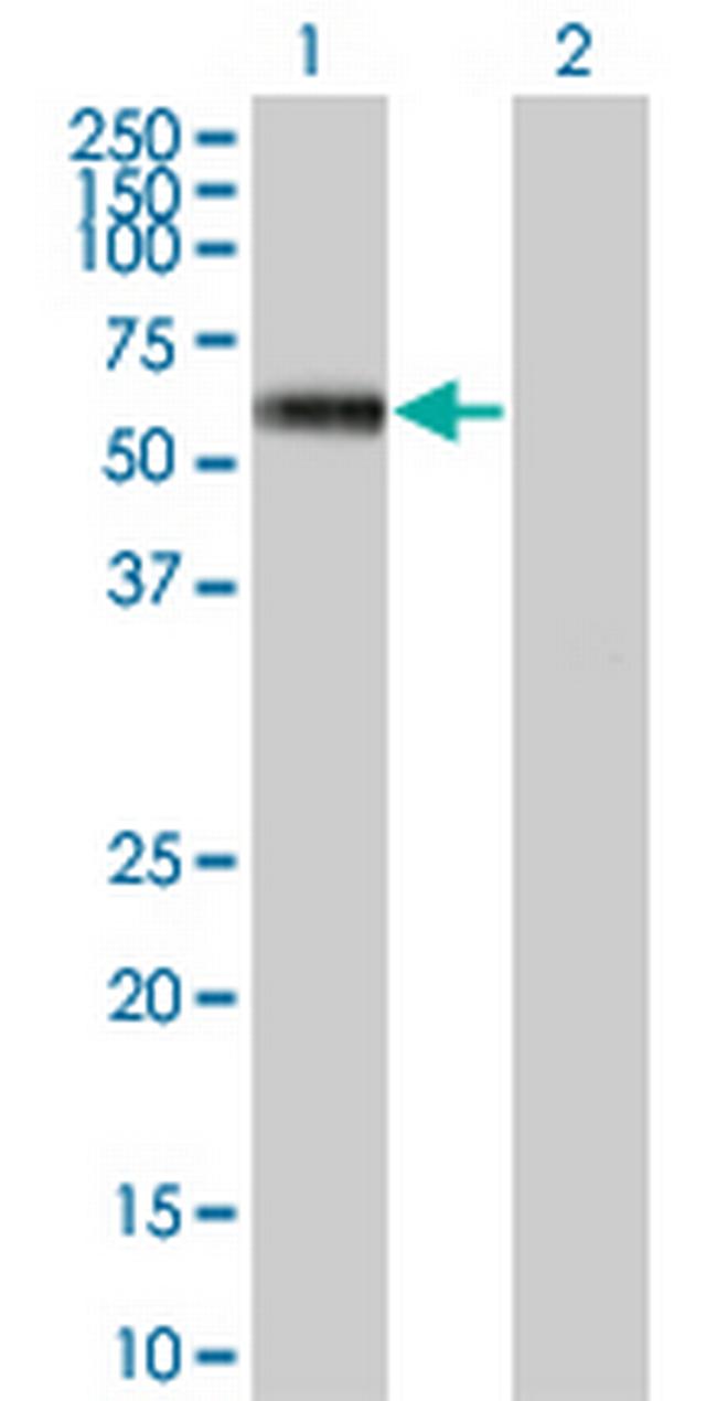 MKNK1 Antibody in Western Blot (WB)