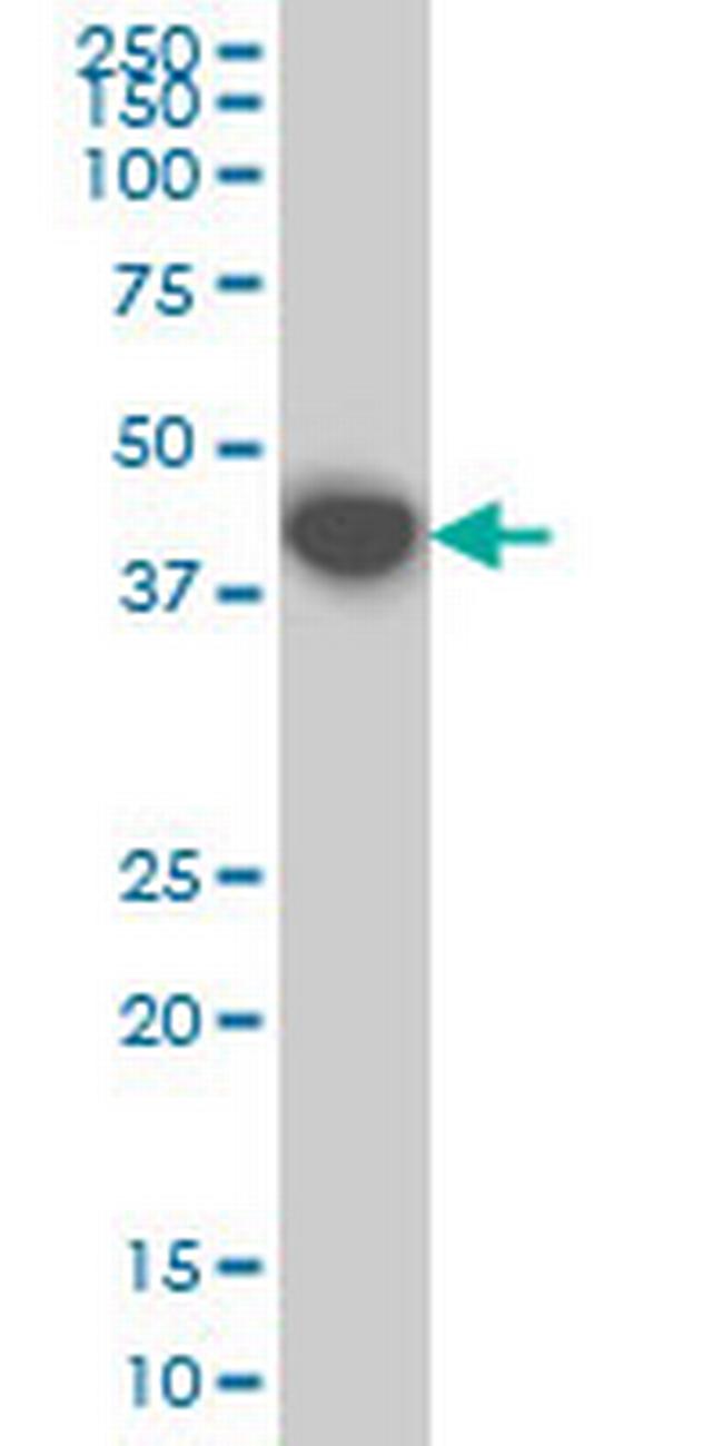 MKNK1 Antibody in Western Blot (WB)