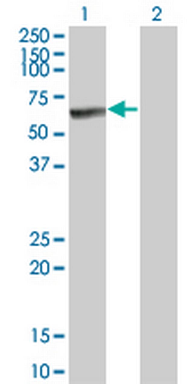 MKNK1 Antibody in Western Blot (WB)