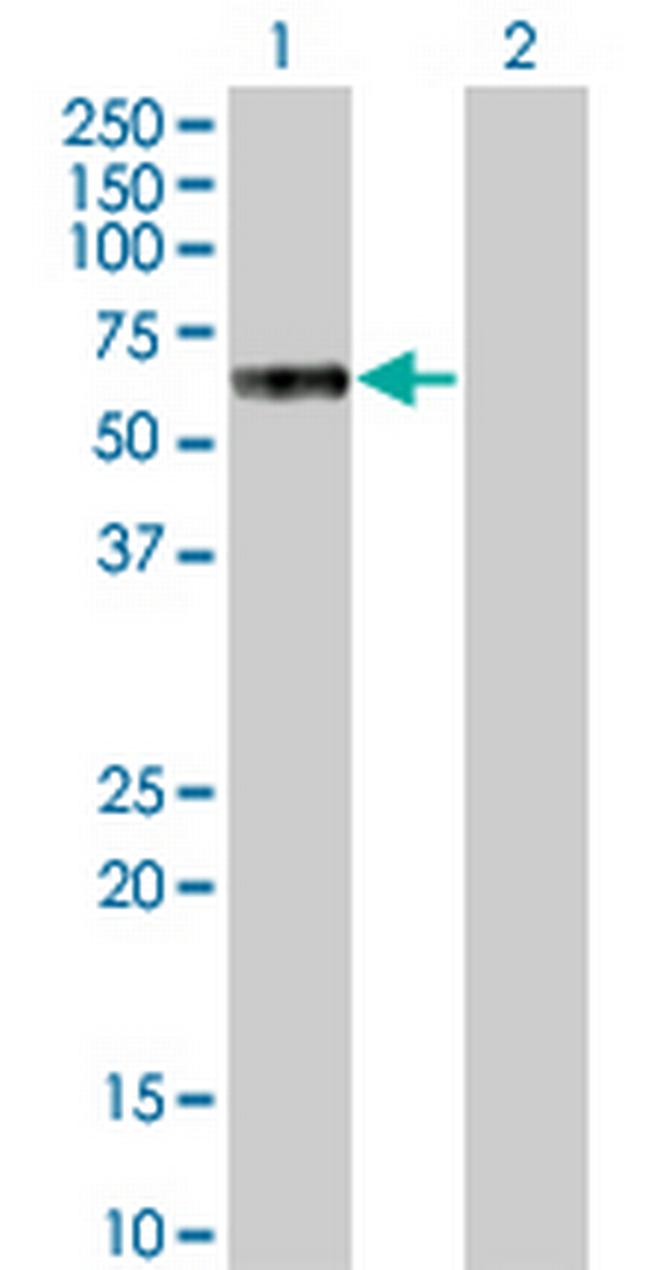 MKNK1 Antibody in Western Blot (WB)