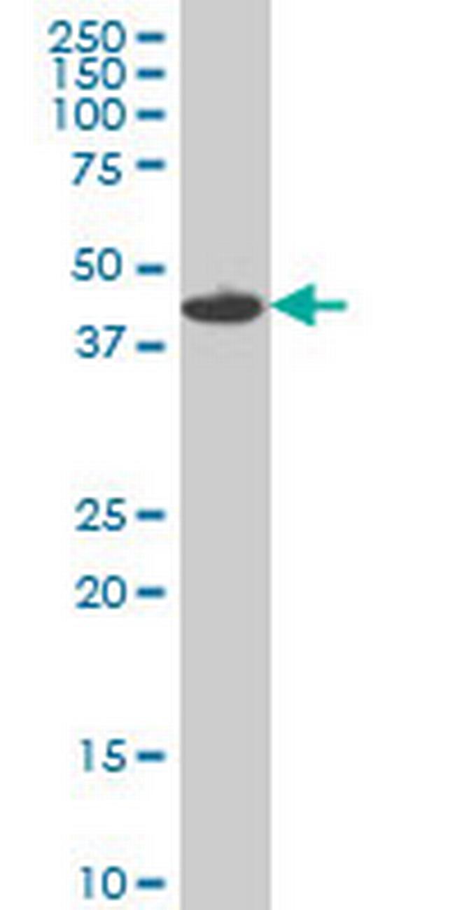 MKNK1 Antibody in Western Blot (WB)