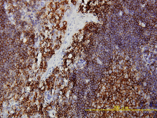 PRKRA Antibody in Immunohistochemistry (Paraffin) (IHC (P))