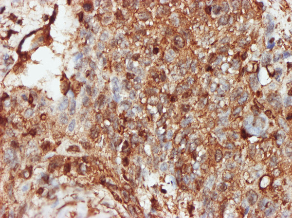 PRKRA Antibody in Immunohistochemistry (Paraffin) (IHC (P))