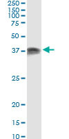 PRKRA Antibody in Immunoprecipitation (IP)