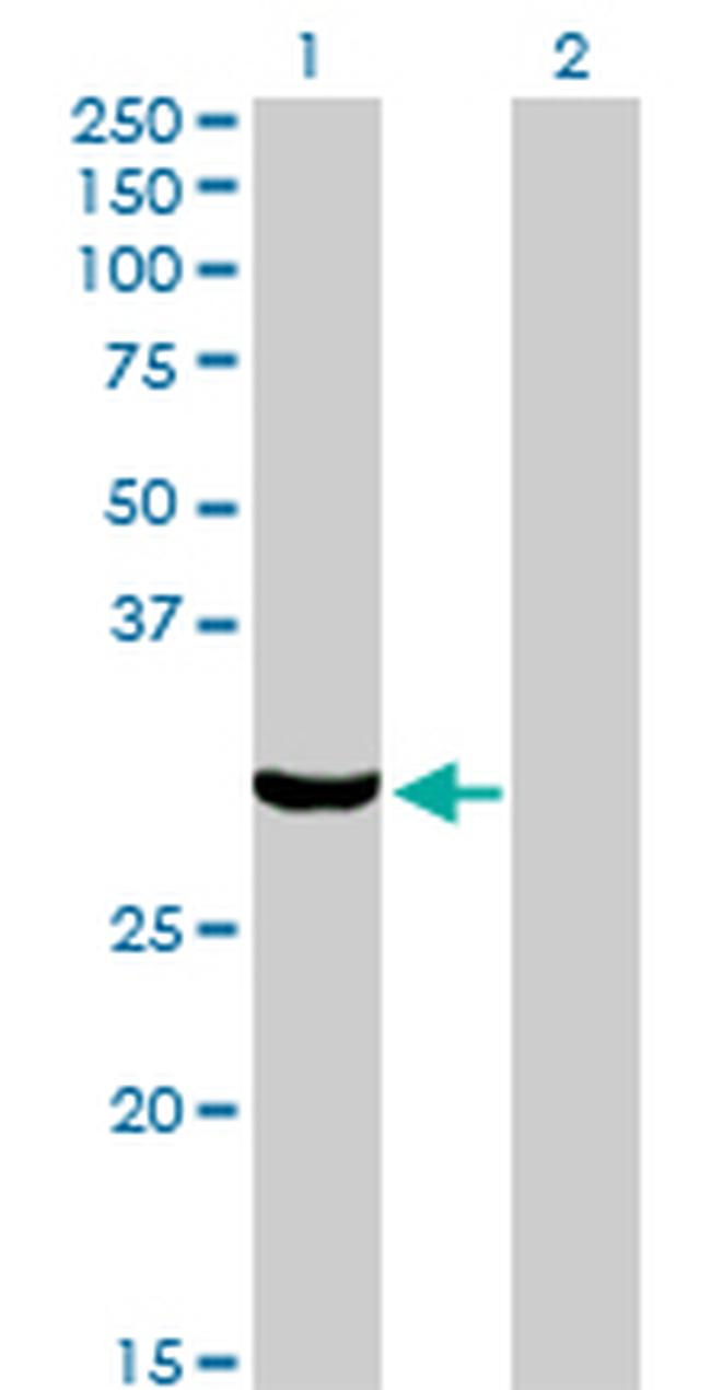 PRKRA Antibody in Western Blot (WB)