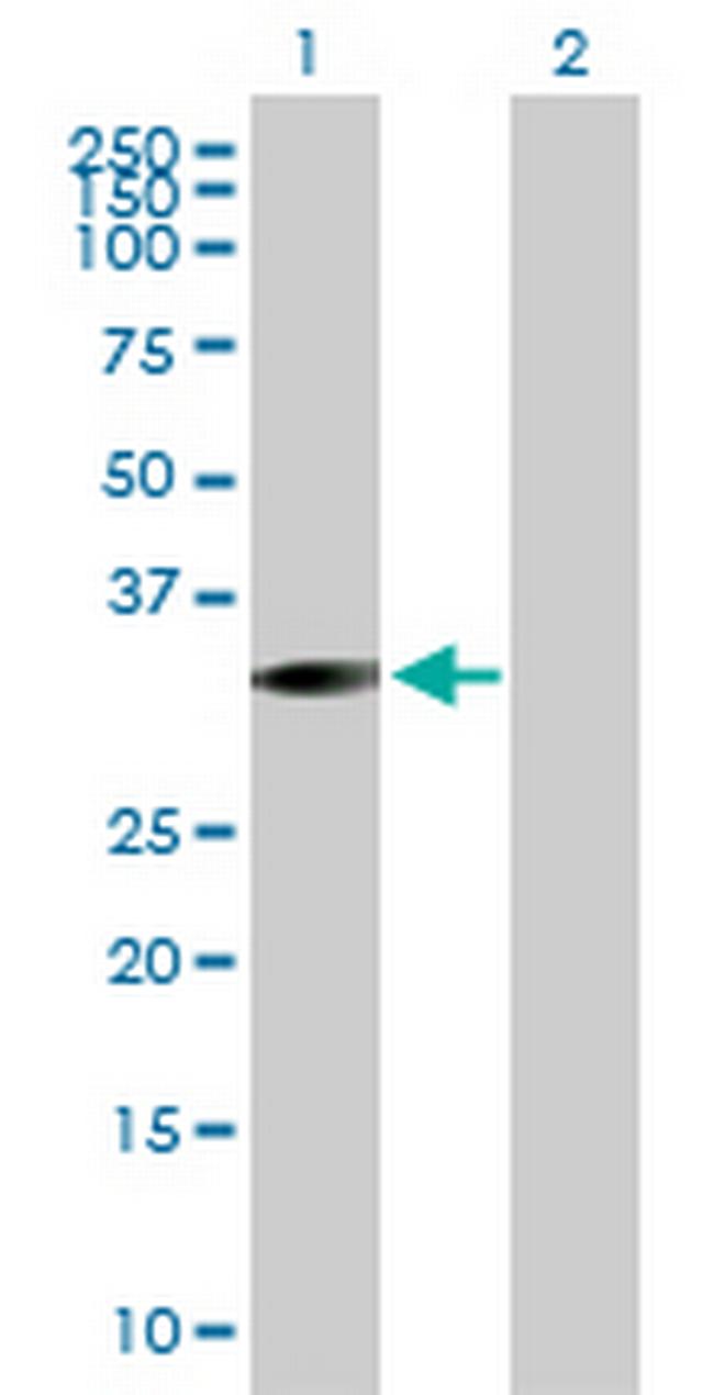 STK16 Antibody in Western Blot (WB)