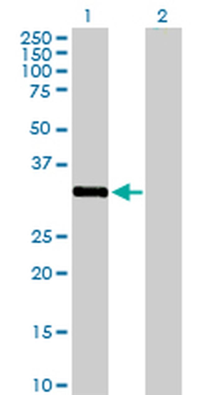 STK16 Antibody in Western Blot (WB)