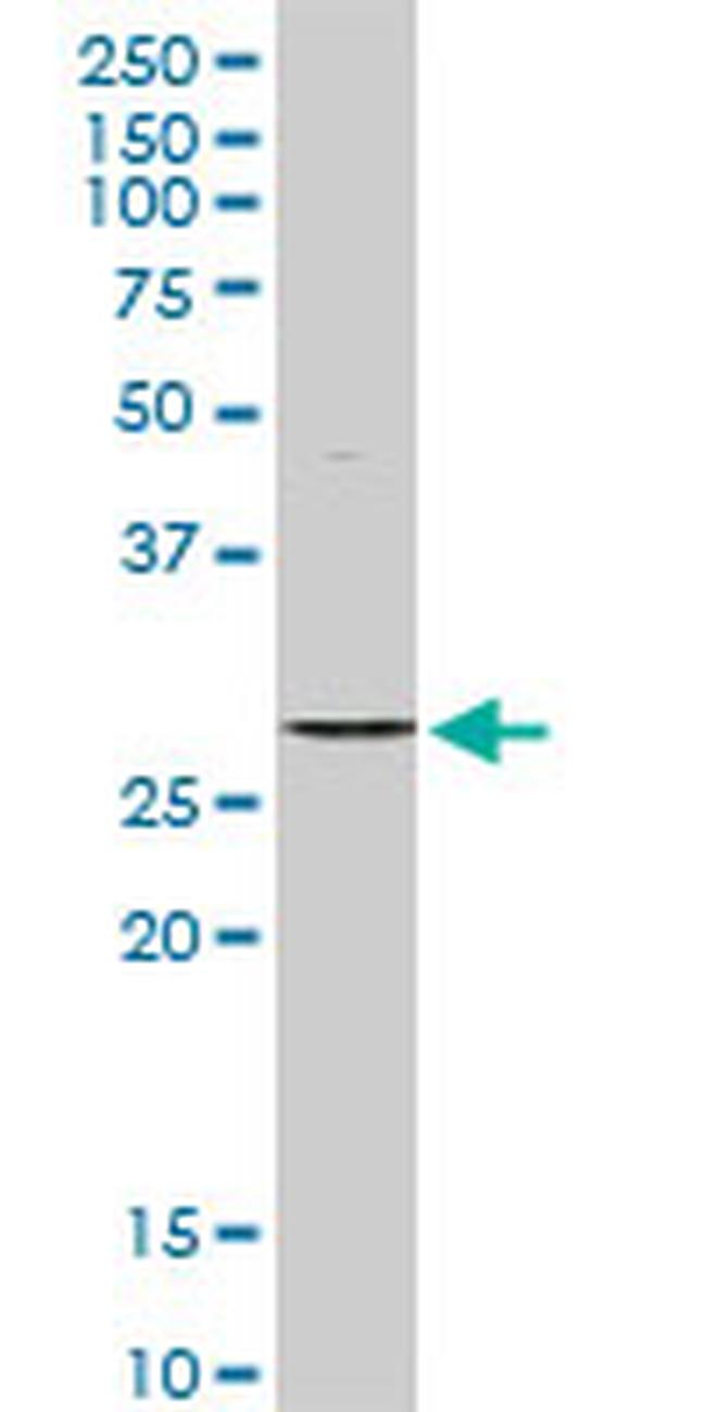 STK16 Antibody in Western Blot (WB)