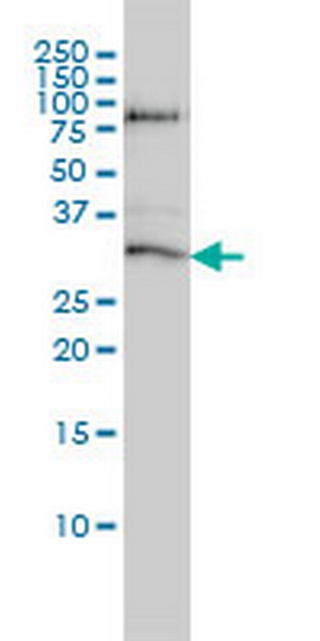 STK16 Antibody in Western Blot (WB)