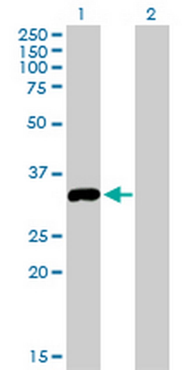STK16 Antibody in Western Blot (WB)