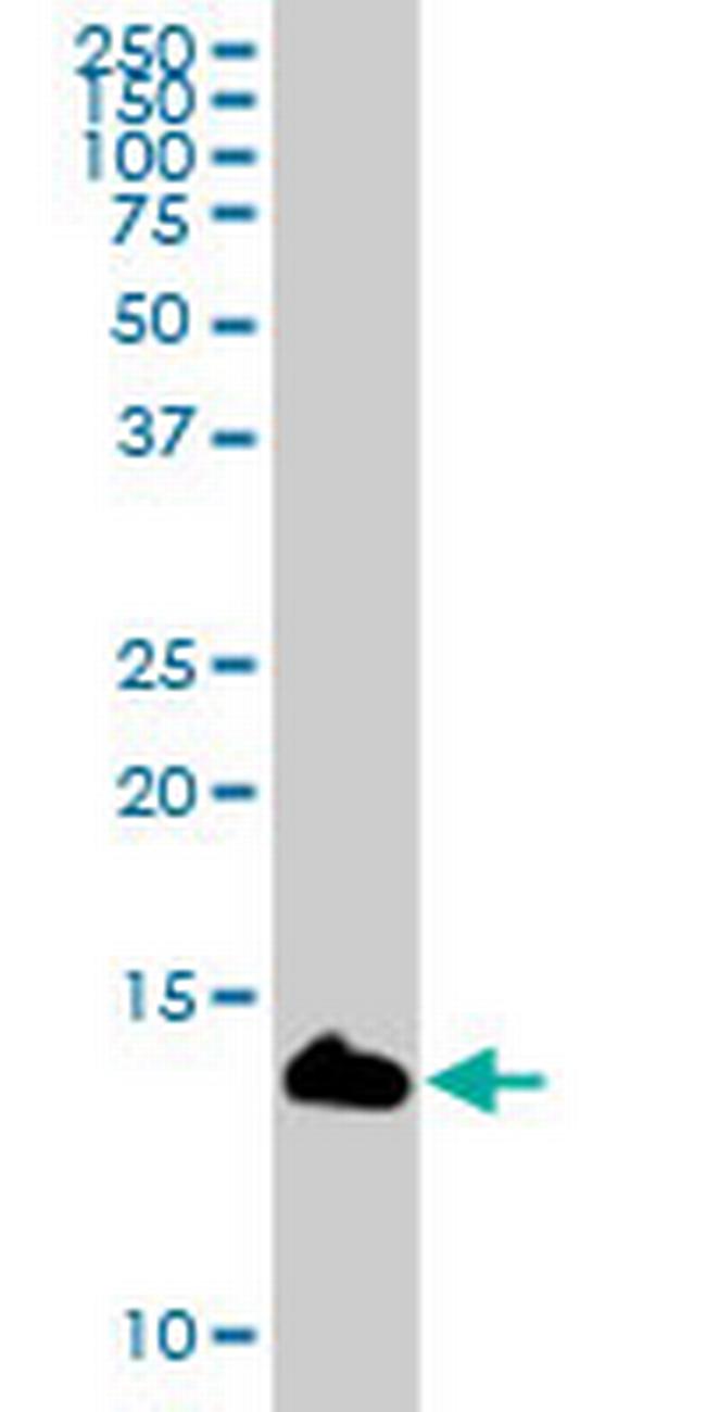 LY6D Antibody in Western Blot (WB)