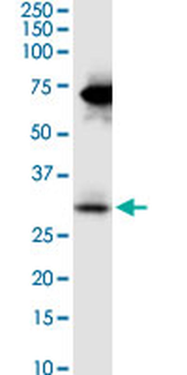 STC2 Antibody in Western Blot (WB)