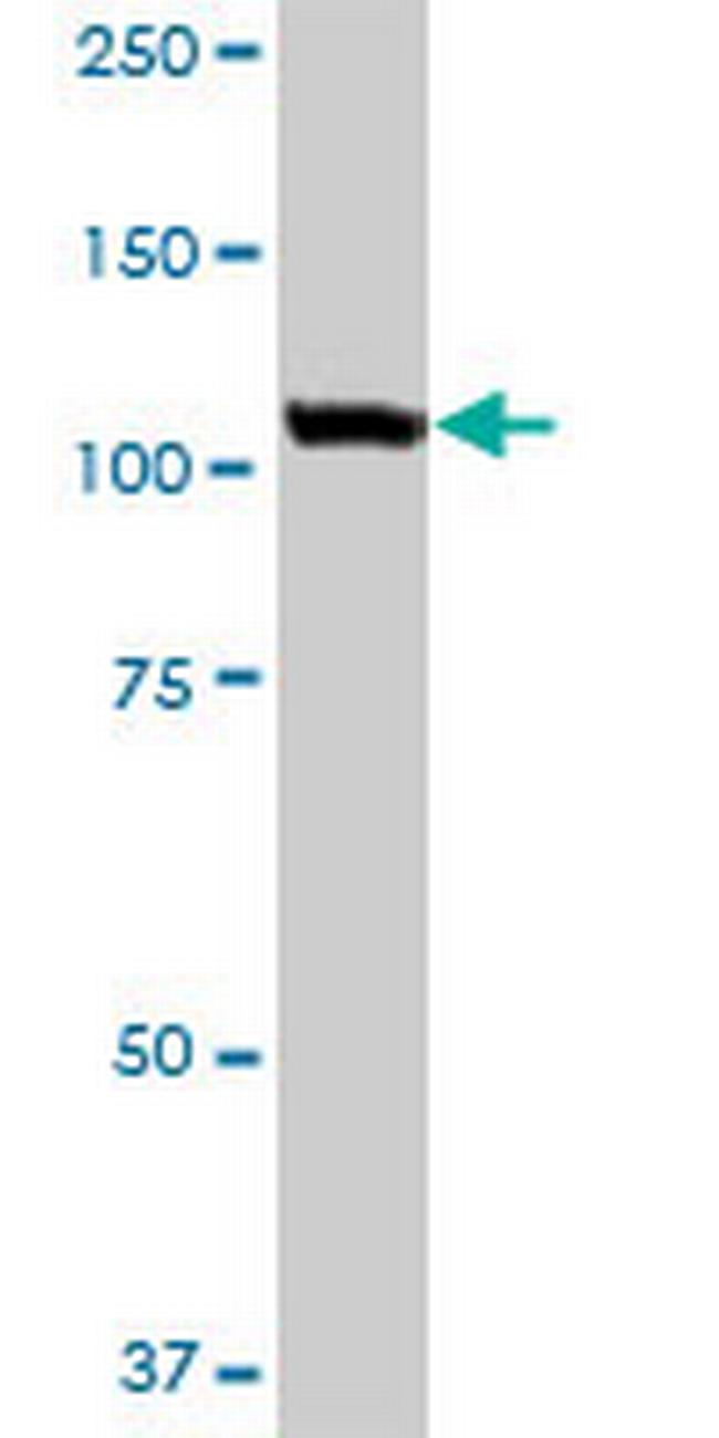 USO1 Antibody in Western Blot (WB)