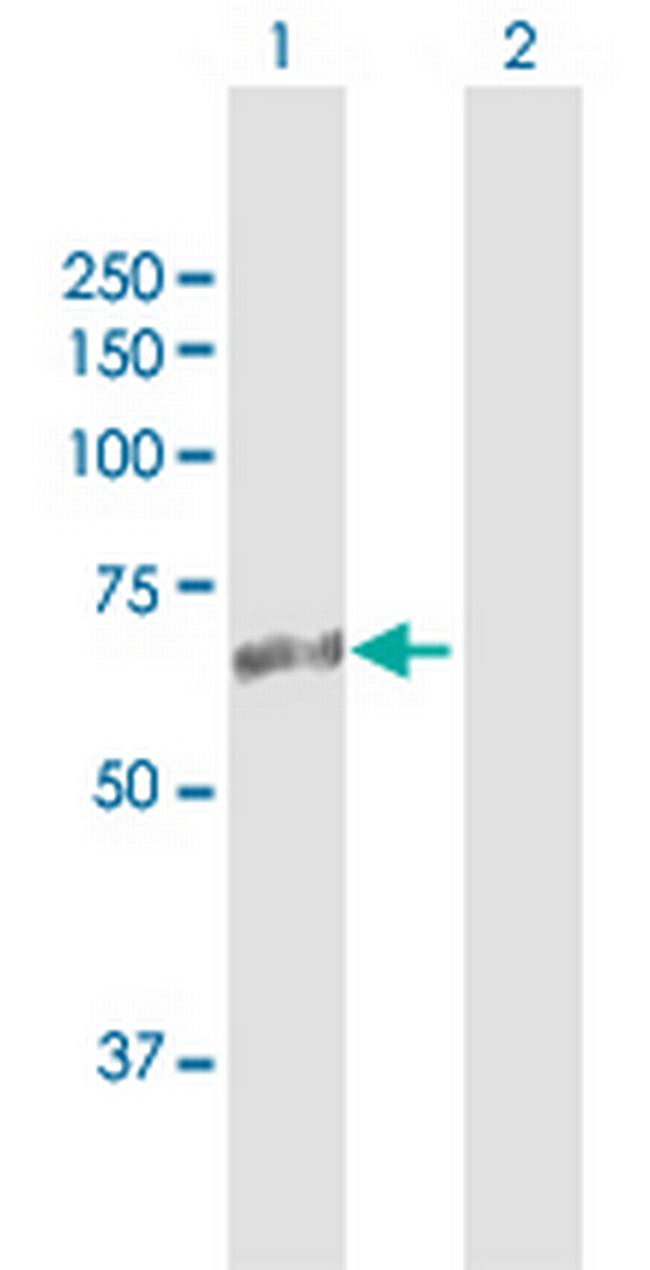 ASMTL Antibody in Western Blot (WB)