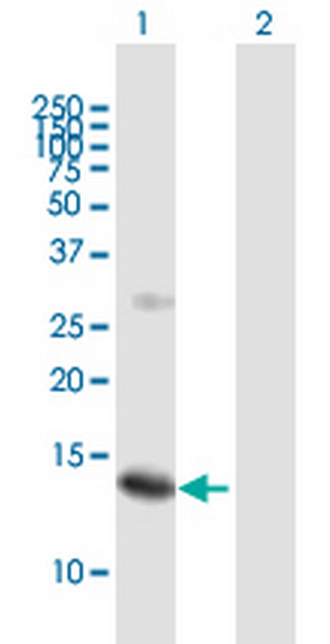 SSNA1 Antibody in Western Blot (WB)