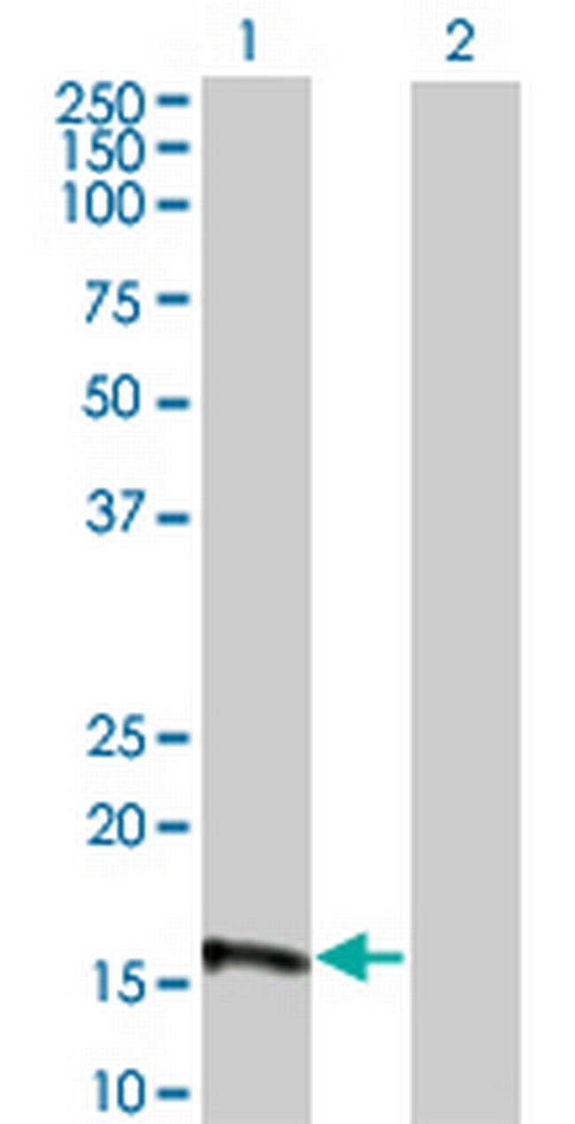 EIF4EBP3 Antibody in Western Blot (WB)