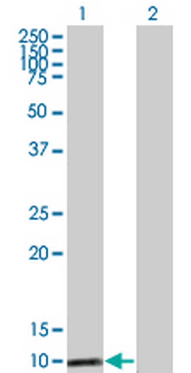 MAPKSP1 Antibody in Western Blot (WB)