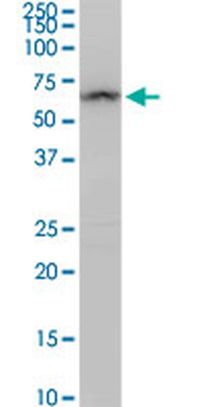 ALDH4A1 Antibody in Western Blot (WB)