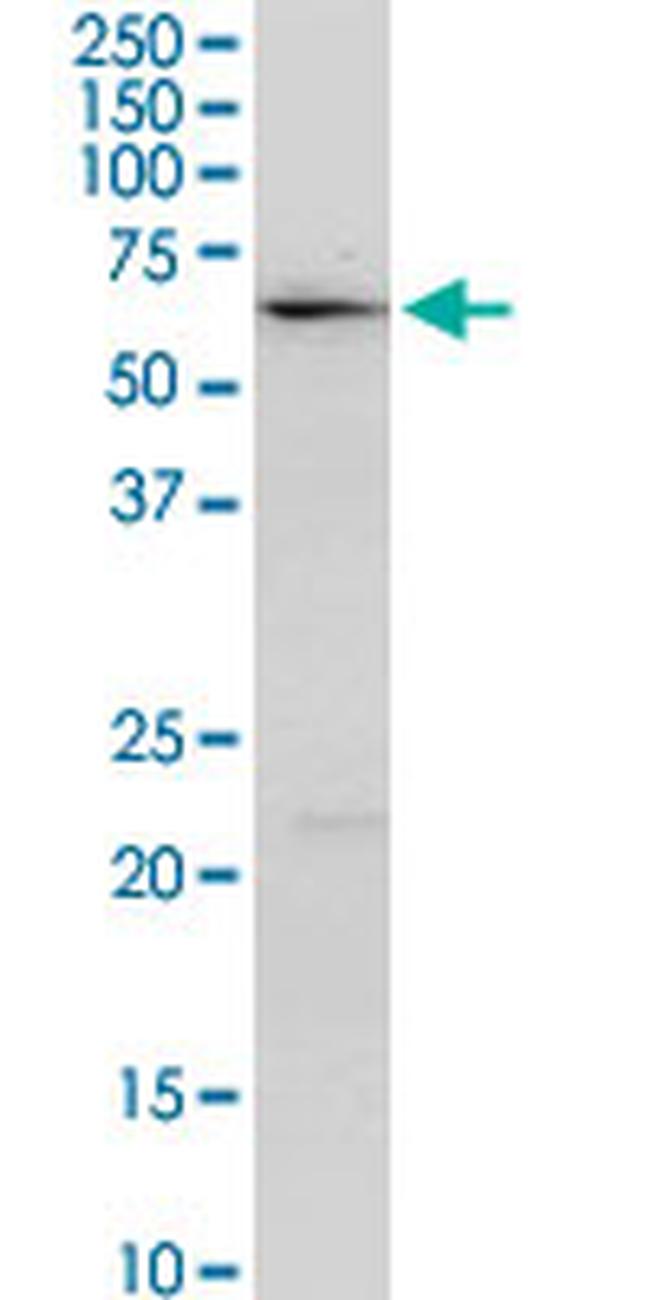 ALDH4A1 Antibody in Western Blot (WB)