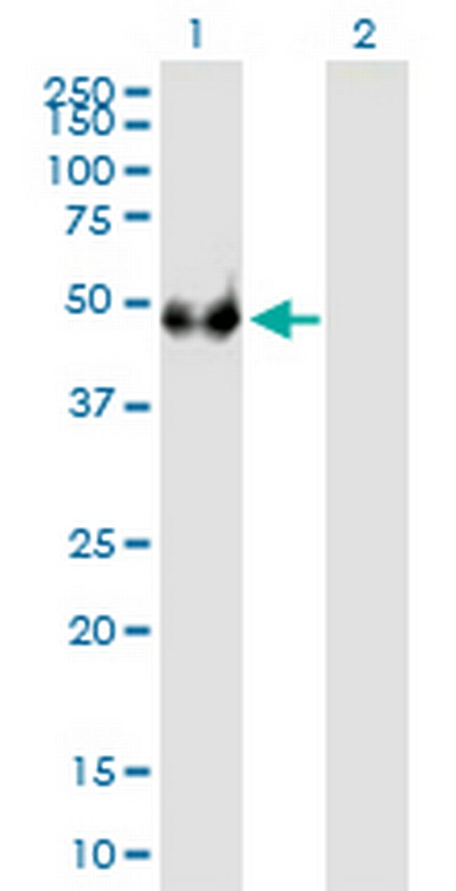 EIF3F Antibody in Western Blot (WB)