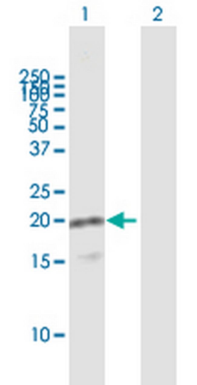 VAMP8 Antibody in Western Blot (WB)