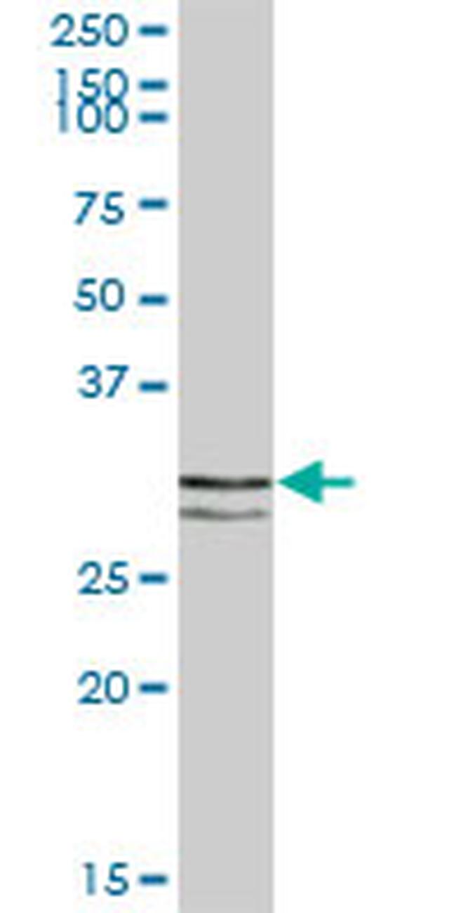 STX11 Antibody in Western Blot (WB)