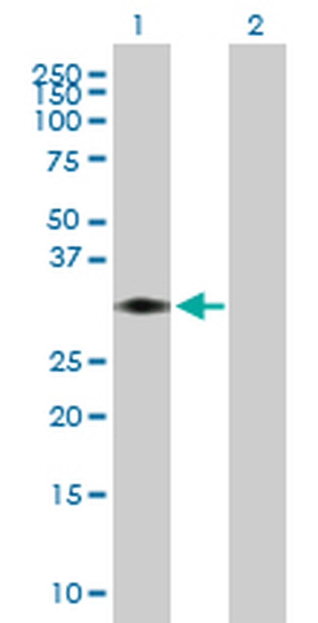 STX11 Antibody in Western Blot (WB)