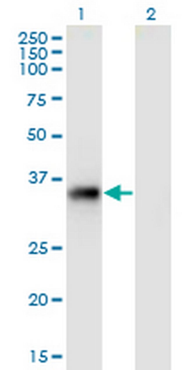 STX11 Antibody in Western Blot (WB)