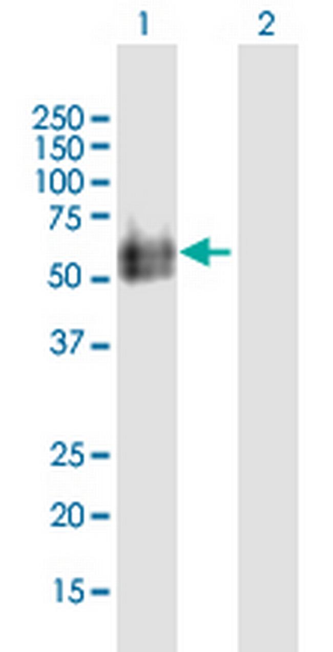 HYAL2 Antibody in Western Blot (WB)