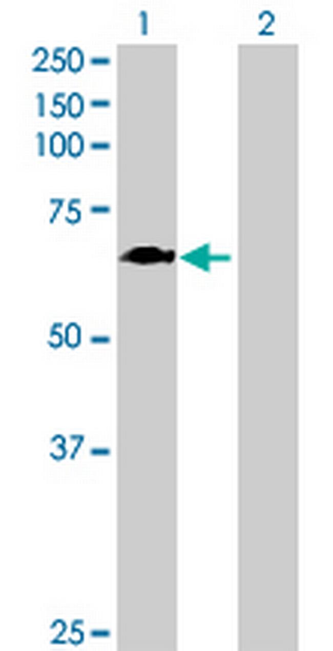 GALNT4 Antibody in Western Blot (WB)