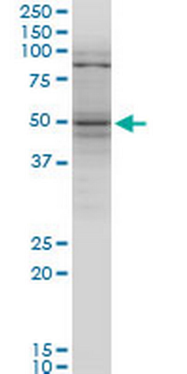 TNFRSF25 Antibody in Western Blot (WB)